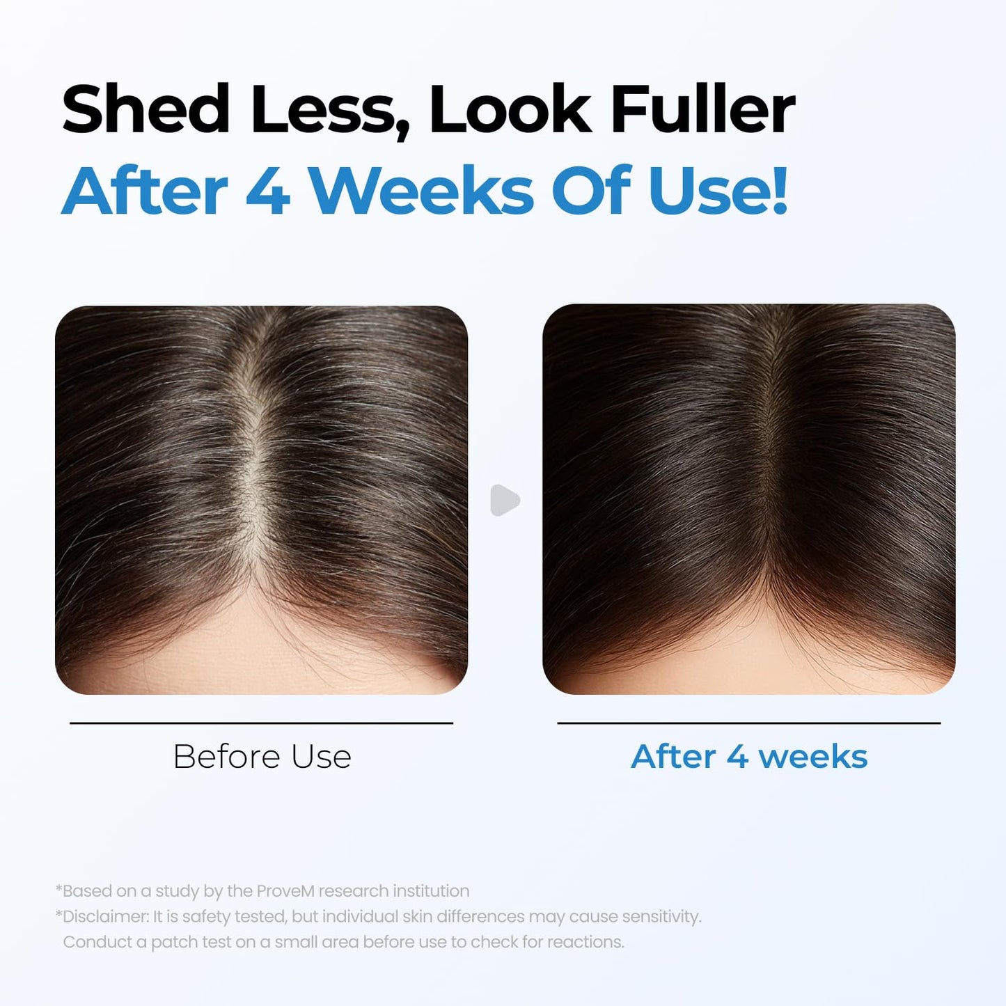 Seapuri Scalpy Hair Growth Serum for Hair Loss & Thinning