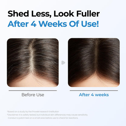 Seapuri Scalpy Hair Growth Serum for Hair Loss & Thinning